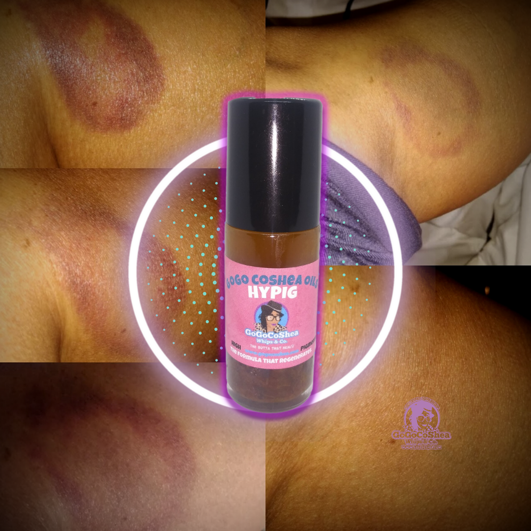 Hyperpigmentation Roll-On